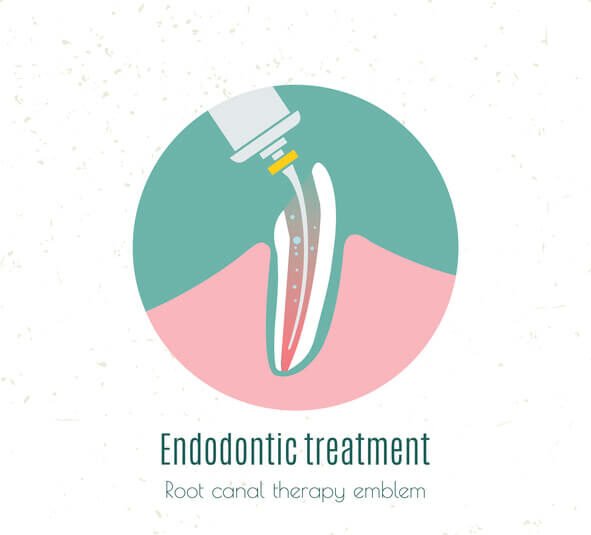 Comparative Analysis Of Different Types Of Root Canal Sealers