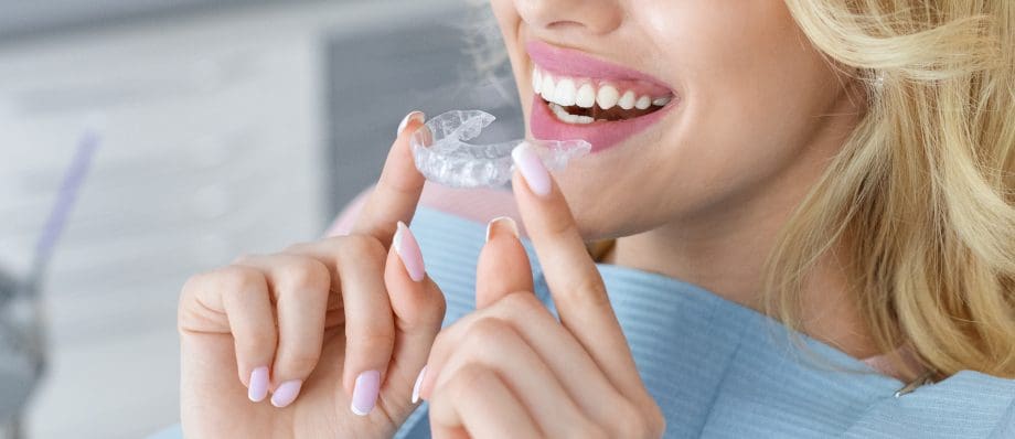 invisalign