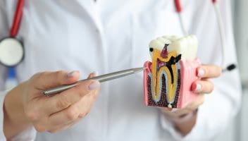 tooth decay