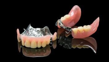 removable partial denture