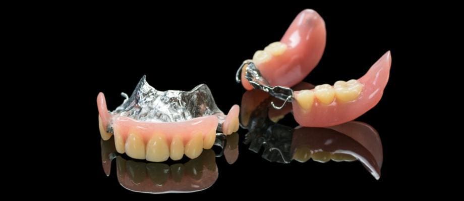 Removable Partial Denture: Pros, Cons, and Maintenance