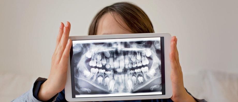 dental x-ray