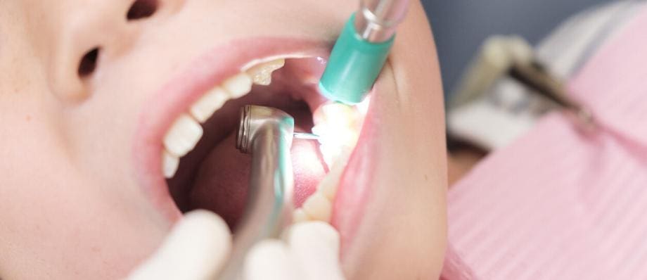 pulpotomy in primary tooth