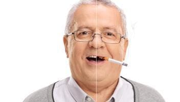 effects of smoking on teeth