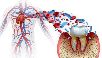 cardiovascular health