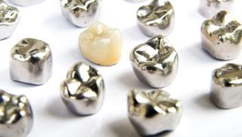 dental alloys