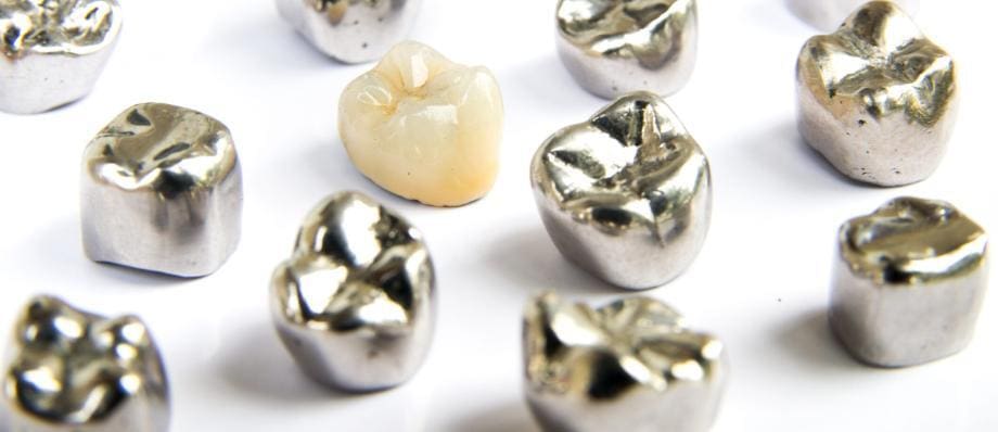 dental alloys