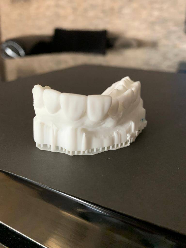 3D Printing in Dentistry: Revolutionizing Dental Care
