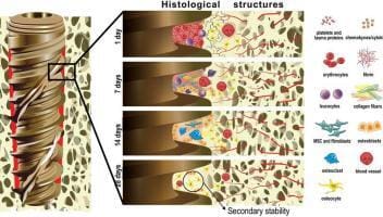 osseointegration