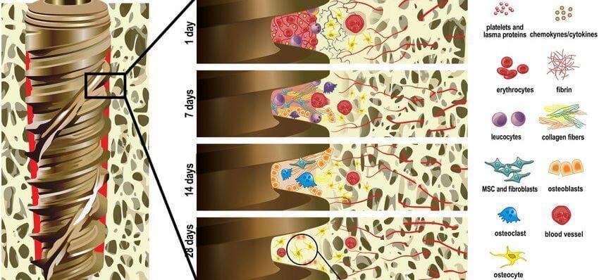 osseointegration