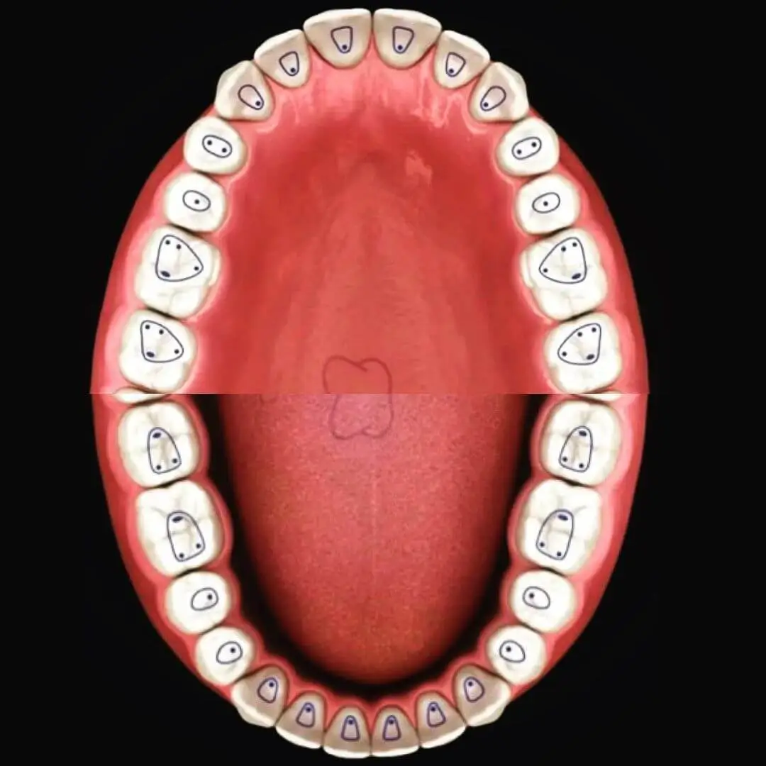 How Many Canals Does Each Tooth Have