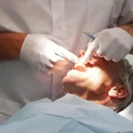 dental crown removal