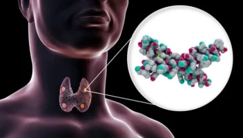 hyperparathyroidism