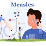 Measles