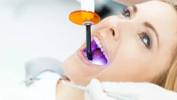 dental curing light