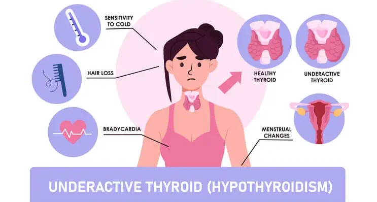 hypothyroidism