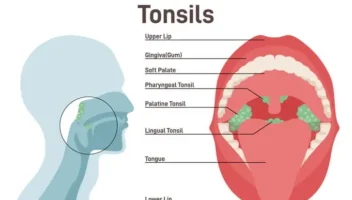 tonsils