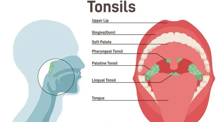 tonsils