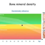 bone density