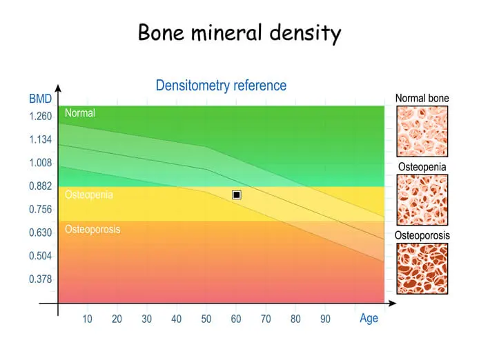 bone density