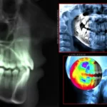 cephalometric