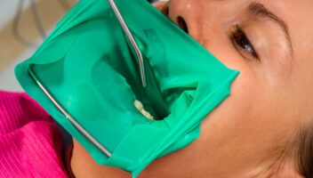 dental dam