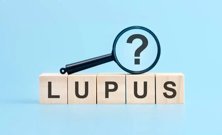 lupus