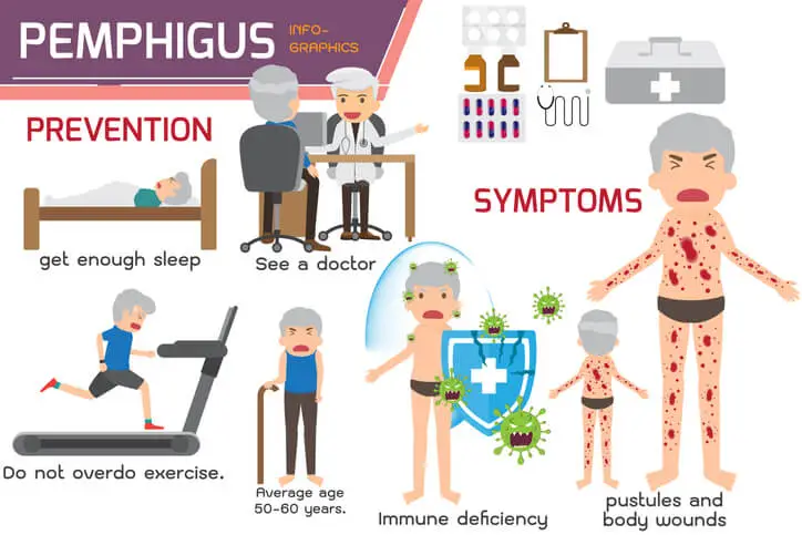 pemphigus