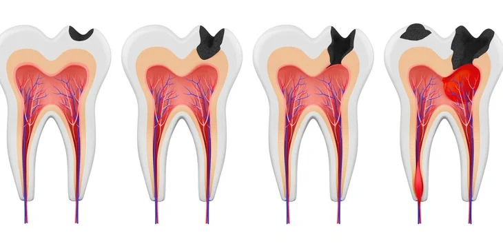 vitality of tooth