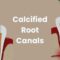 calcified root canals