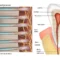 dentin hypersensitivity