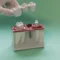 mini dental implants