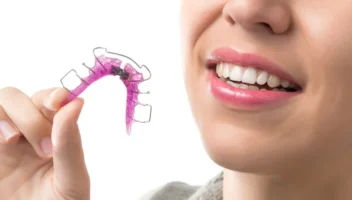 removable orthodontic appliances