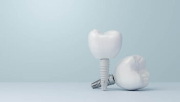 zirconia implants