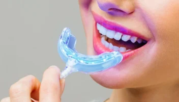 home teeth whitening kits