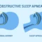 sleep apnea