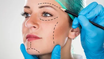 Cosmetic surgeries