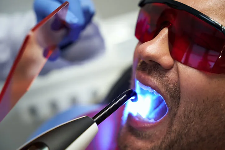 UV light dentistry