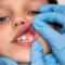 oral soft tissue injuries