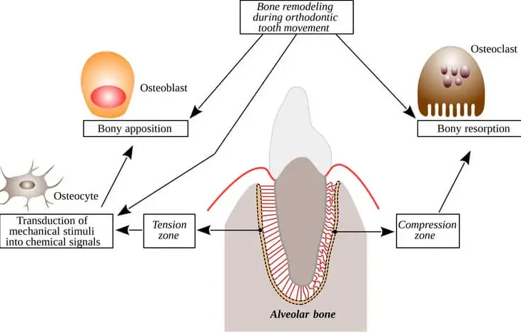 tooth movement