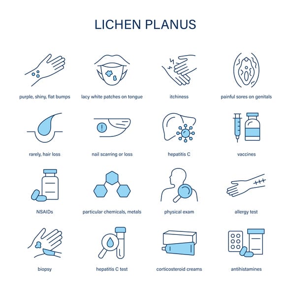 lichen planus