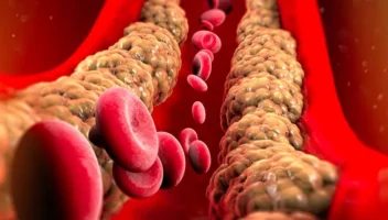 triglycerides