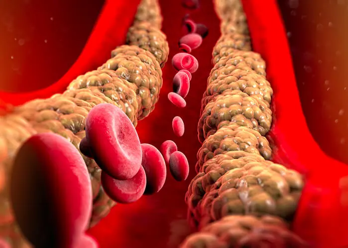 triglycerides