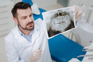 ankylosed teeth