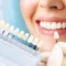 Tooth colour charts