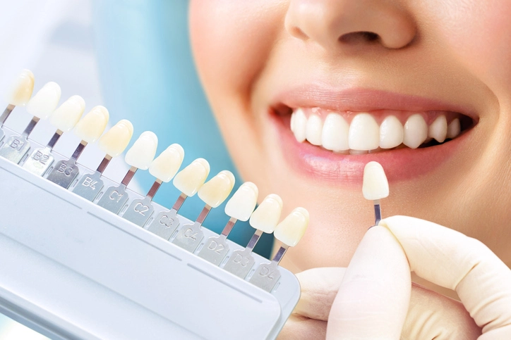 Tooth colour charts