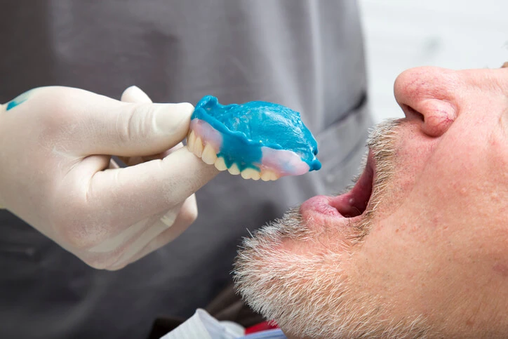 denture relining