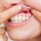 gum line