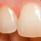 tooth texture
