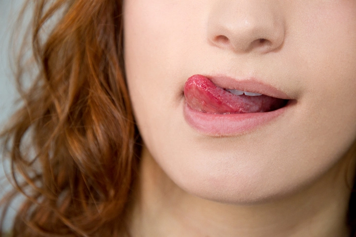 treatments for dry mouth